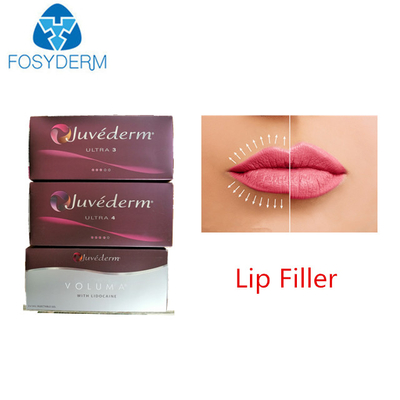 Llenador cutáneo ácido hialurónico ultra 3 de Juvederm para los labios de la cara