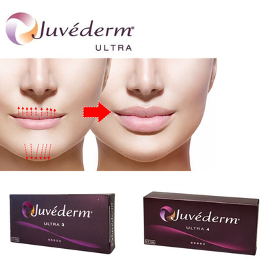 Juvederm Ultra3 Hyaluronic Acid Filler para labios Gel para inyección cutánea precargado