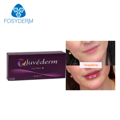 Inyección ácida hialurónica ligada cruz cutánea de los llenadores del labio de Juvederm 2*1ml para antienvejecedor