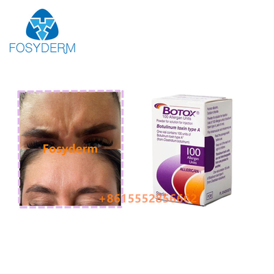Eliminar arrugas inyección alergeno toxina botulínica Botox tipo A 100 unidades