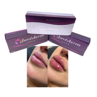 Hyalurónico 2x1 ml Juvederm Ultra 4 inyectable
