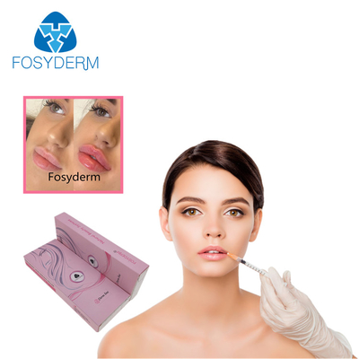 Inyección cutánea inyectable del gel del ácido hialurónico de los llenadores del aumento del labio de Fosyderm 2ml