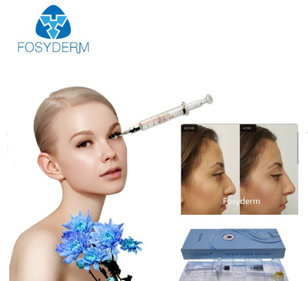 Línea profunda inyecciones de Fosyderm 1ml del ácido hidroclórico en la cara para la nariz para arriba