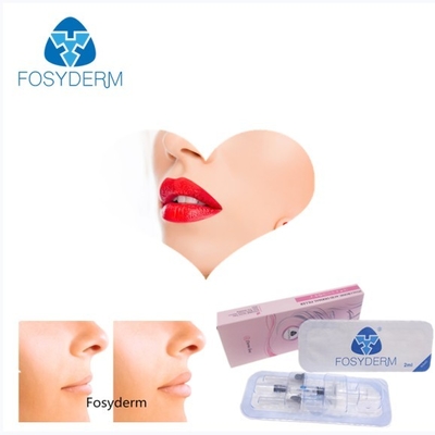 Gelifiqúese Fosyderm 2ml cruzan el llenador cutáneo ligado del ácido hialurónico para el aumento del labio