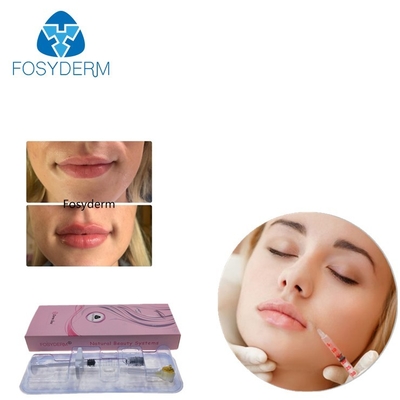 Gelifiqúese Fosyderm 2ml cruzan el llenador cutáneo ligado del ácido hialurónico para el aumento del labio