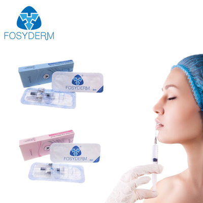 Llenador ácido hidroclórico del labio de Fosyderm con las jeringuillas pre llenadas para el cuidado de piel