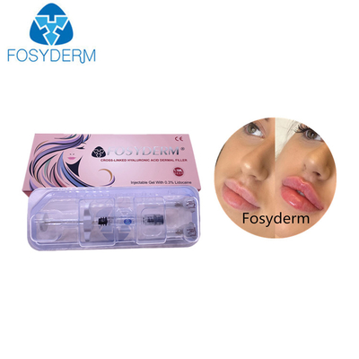 La cruz pura de Fosyderm el 100% ligó el ácido hialurónico de la inyección 1ml para el llenador del labio