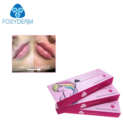Fosyderm 1 ml de ácido hialurónico inyecciones de relleno dérmico para aumentar el tamaño de los labios