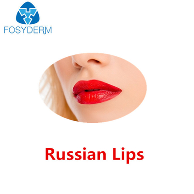Juvederm ultra 3 labios rusos ácidos hialurónicos del llenador cutáneo con lidocaína