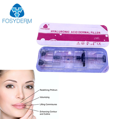 plenitud de los labios 2ml inyectando el llenador cutáneo ácido hialurónico de Fosyderm