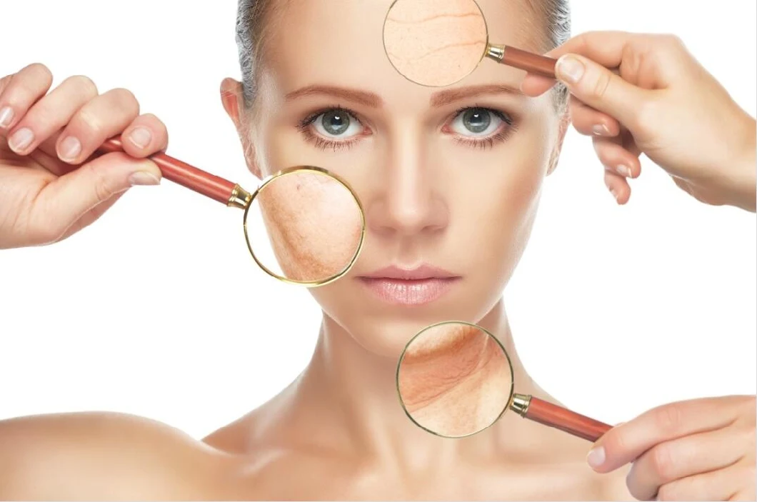Hyamely ácido hialurónico Meso Solución Dermal relleno suero de mesoterapia para el cuidado de la piel 0