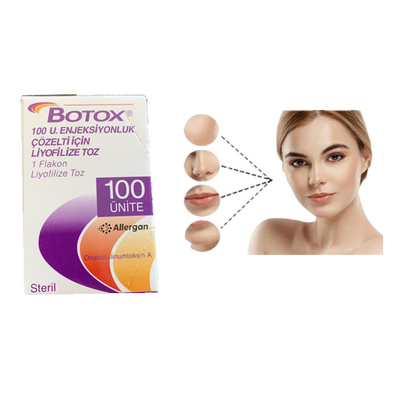 Operación Botulinum del retiro de la arruga de la inyección de Botox de la toxina de Allergan 100units