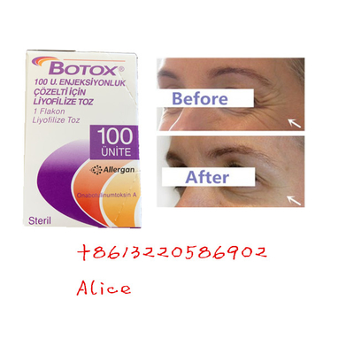 La toxina Botulinum Allergan de la arruga anti antienvejecedora mecanografía un polvo de Botox