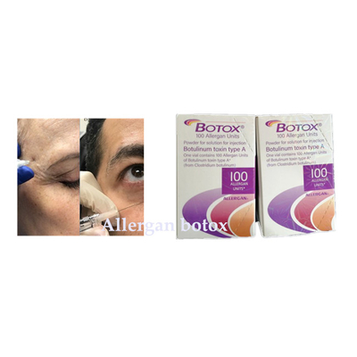 La inyección Botulinum de Allergan Botox de la toxina para la arruga quita