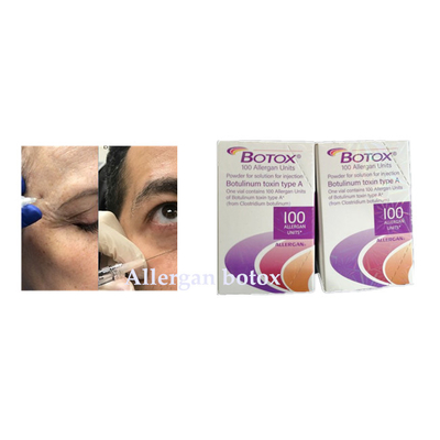 La inyección Botulinum de Allergan  de la toxina para la arruga quita