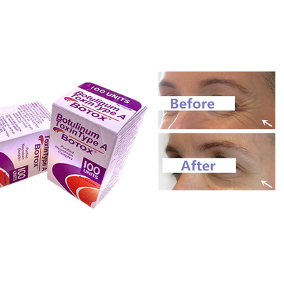 La inyección Botulinum de Allergan  de la toxina para la arruga quita