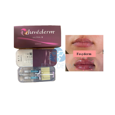Relleno dérmico Fosyderm del ácido hialurónico de Voluma para el aumento del labio