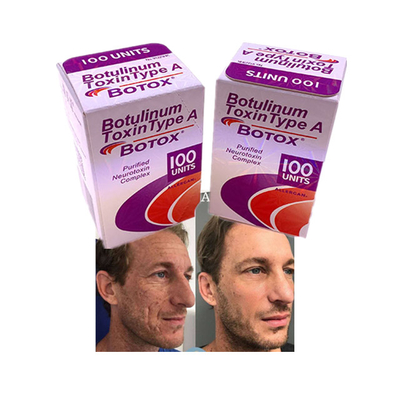 Arruga antienvejecedora de los cosméticos de Allergan del polvo de la inyección de  100 unidades