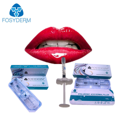 Una inyección más regordeta Fosyderm 1ml Derm del llenador de la ha de los labios