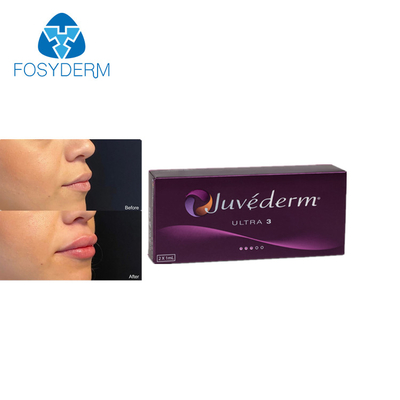 La cruz de Juvederm Ultra3 2ml ligó la inyección ácida hialurónica del llenador cutáneo de los labios