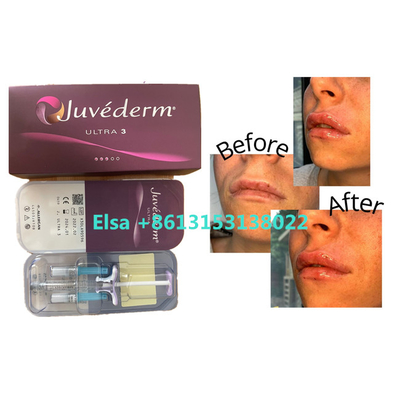 Llenador cutáneo de Juvederm de los productos cosméticos para los labios de la cara