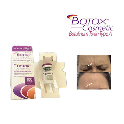 Tipo Botulinum llenador cutáneo de la toxina A de los productos de la inyección antienvejecedora de Botox