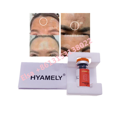 Toxina Botulinum de Hyamely  mecanografiar un cosmético coreano de  100u