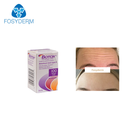Allergan Botox 100 arrugas antis de la toxina Botulinum de las unidades mecanografía una inyección