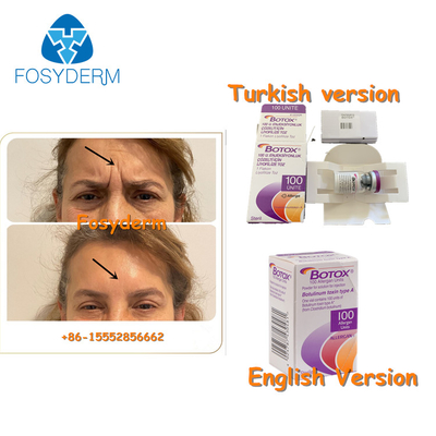 100Units Allergan Toxion Botulinum para quitan el tipo facial A de Botox de las arrugas