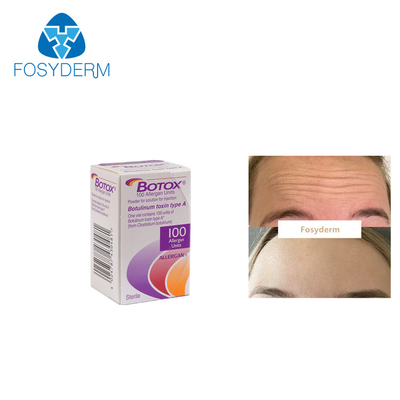 100Units Allergan Toxion Botulinum para quitan el tipo facial A de  de las arrugas
