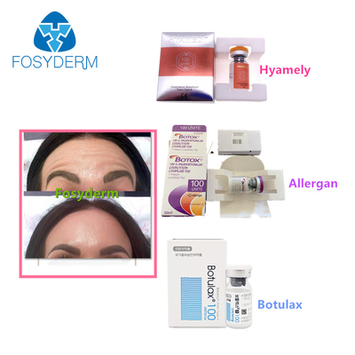 100 unidades mecanografían a toxina Botulinum Allergan la inyección facial anti de  Botulax de las arrugas