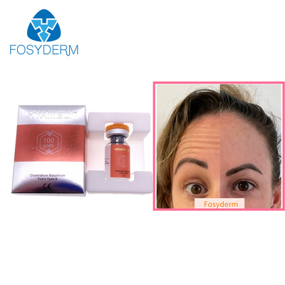 100 unidades mecanografían a toxina Botulinum Allergan la inyección facial anti de  Botulax de las arrugas
