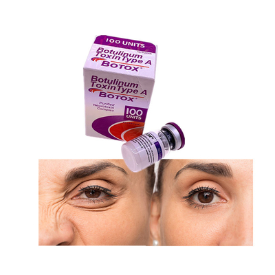 Quitando las líneas faciales unidades Botulinum Allergan o de la toxina 100