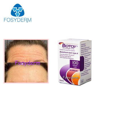 100 unidades de Toxina Botulínica Alérgico Elimina arrugas faciales Inyección Botox Tipo A