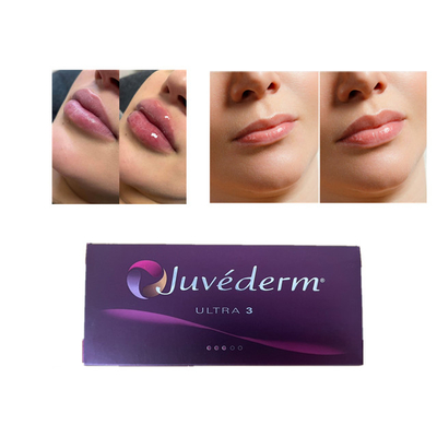 Juvederm Ácido hialurónico Relleno dérmico antiarrugas Relleno labial facial