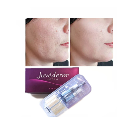 Juvederm Ácido hialurónico Relleno cutáneo antienvejecimiento 2*1ml Relleno facial