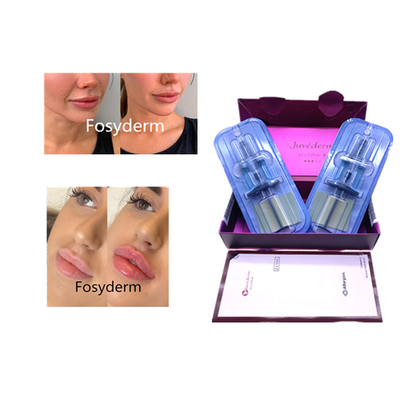 Juvederm Ácido hialurónico Relleno cutáneo antienvejecimiento 2*1ml Relleno facial