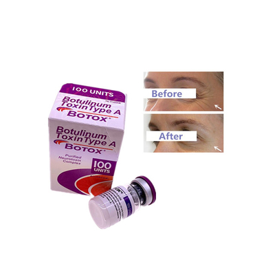 Insoluble en agua Allergan 100 unidades Toxina botulínica Perfecto para la fabricación