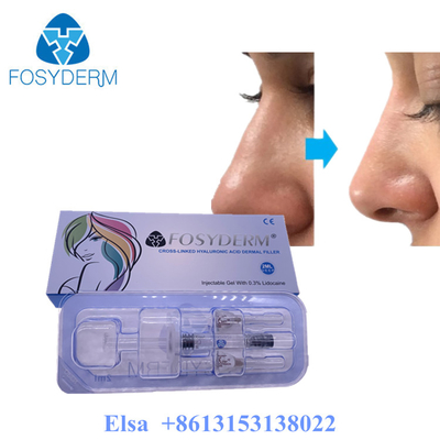 Fosyderm Profundo 2ml Relleno dérmico para el rejuvenecimiento facial Relleno HA