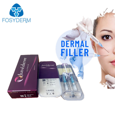 Juvederm Ultra3 Relleno cutáneo inyectable para la inyección de ácido hialurónico en la cara