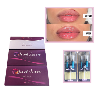 Juvederm Voluma Ultra3 Ultra4 HA Gel de relleno de 2 ml de ácido hialurónico
