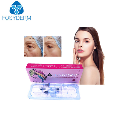 OEM Hyaluronic Acid Dermal Filler para piel llena y radiante