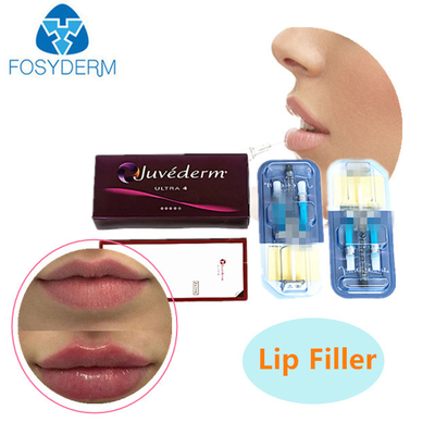 2 ml de relleno cutáneo con ácido hialurónico JUVEDERM Gel inyectable para relleno de arrugas