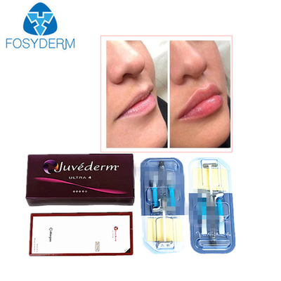 Juvederm Ácido hialurónico Relleno dérmico contra arrugas Inyección para la cara