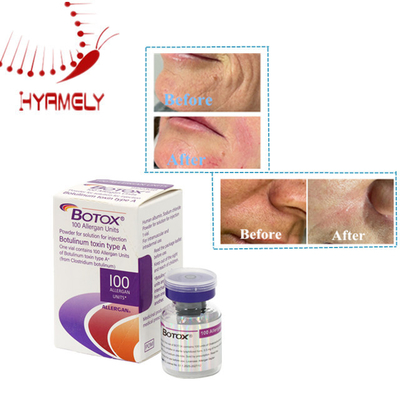 Tratamiento eficaz de la piel Toxina botulínica 100 unidades Polvo de alérgeno inyectable