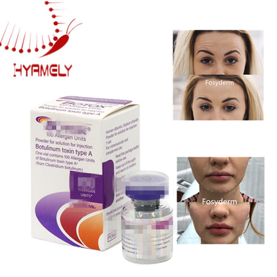 Inyección de toxina botulínica Allergan, relleno dérmico antiarrugas para la solución de reducción de arrugas faciales y de cuello
