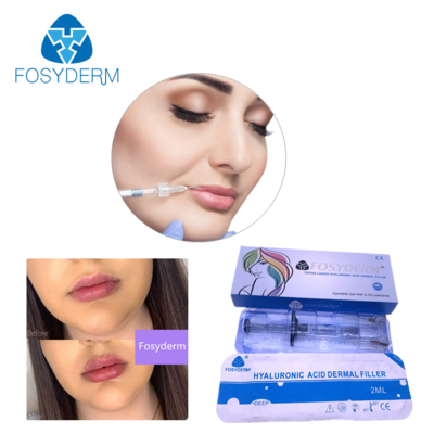Relleno dérmico de ácido hialurónico 24mg/ml para cara, labios, mejillas y mentón