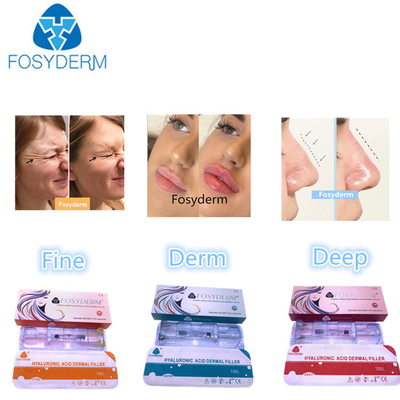 Rellenos dérmicos de ácido hialurónico 1ml-50ml para rostro y cuerpo