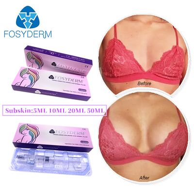 Fosyderm Cross-Linked Hyaluronic Acid Dermal Filler for Plastic Surgery