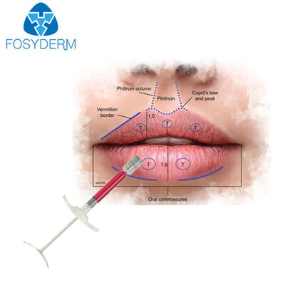 Más popular Relleno de labios rojos de 1ml, relleno dérmico inyectable